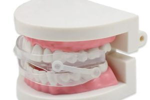 口腔矫正器对打鼾有效吗？